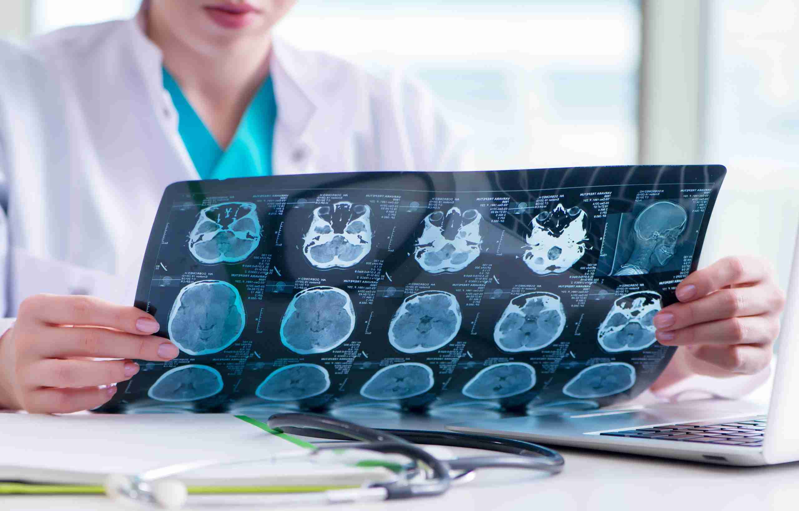 Depo-Provera litigation leads offered by On Point Legal Leads for law firms specializing in mass tort cases.