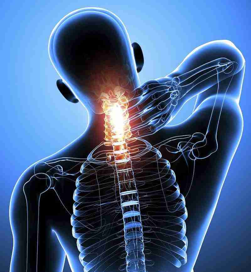 An anatomical illustration showing a person with highlighted spinal trauma, representing